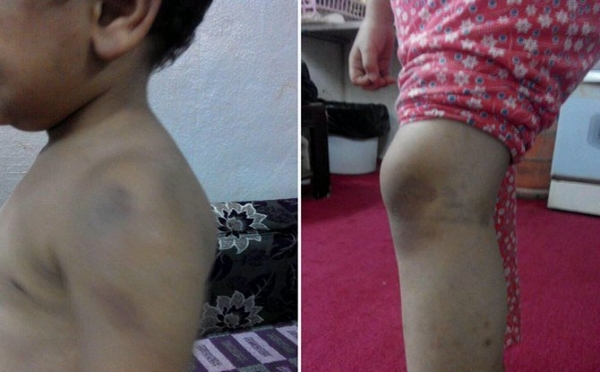 شرطة #الباحة: صور ومقاطع الأطفال المعنفين خارج حدودنا الإدارية