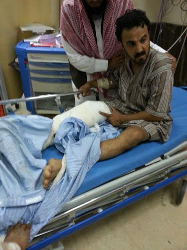 إصابة مواطن بتهتّكات وكسور بساقه بعد انقطاع “ليور” سحب بالدّرب