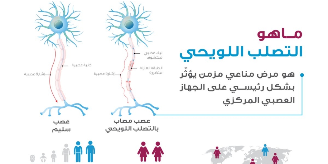 Ù…Ø¹Ù„ÙˆÙ…Ø§Øª Ø¹Ù† Ù…Ø±Ø¶ Ø§Ù„ØªØµÙ„Ø¨ Ø§Ù„Ù„ÙˆÙŠØ­ÙŠ ÙˆÙ‡Ø°Ù‡ Ø£Ø¨Ø±Ø² Ø£Ø¹Ø±Ø§Ø¶Ù‡ ØµØ­ÙŠÙØ© Ø§Ù„Ù…ÙˆØ§Ø·Ù† Ø§Ù„Ø¥Ù„ÙƒØªØ±ÙˆÙ†ÙŠØ©