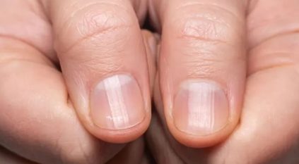 اختبار بالأصابع يكشف إصابتك بسرطان الرئة