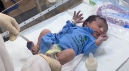 في يوم عرفة.. مستشفى جبل الرحمة يستقبل أول حالة ولادة لحاجة باكستانية