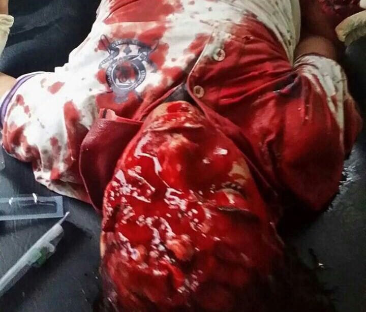 مجزرة بحق الطفولة.. مليشيا الحوثي تقتل وتصيب 13 طفلا في تعز